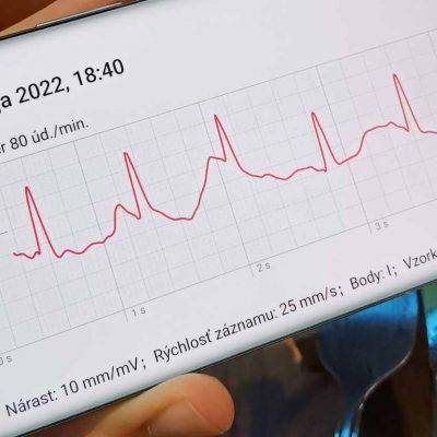 HUAWEI Watch GT3 Pro: zmeral som si EKG