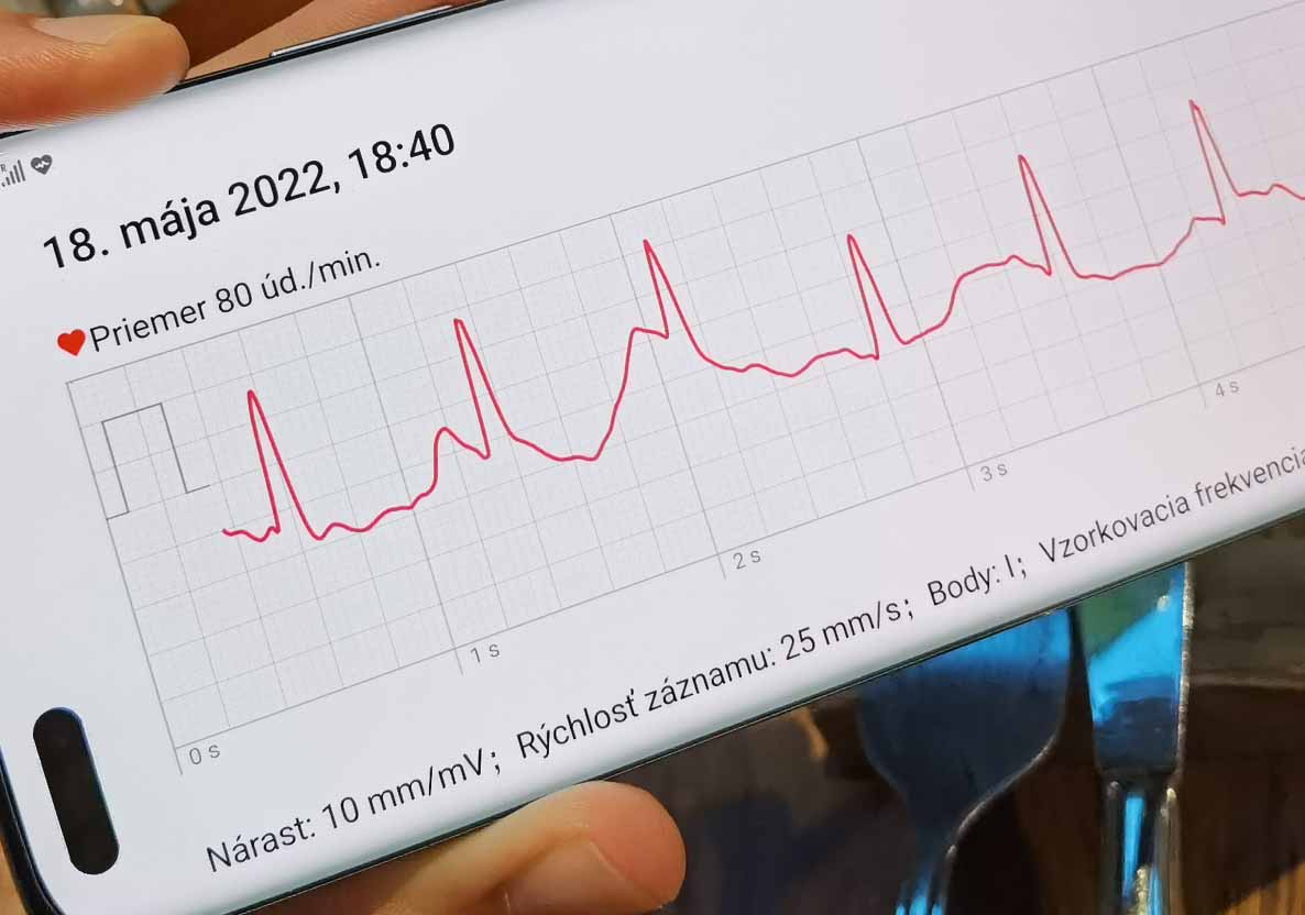 HUAWEI Watch GT3 Pro: zmeral som si EKG