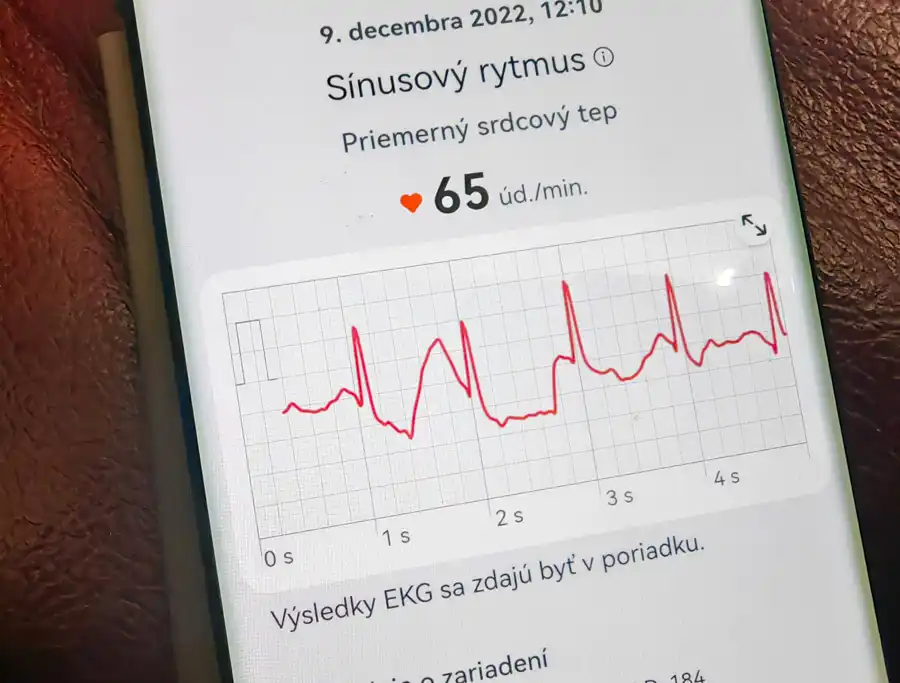 Huawei Watch D: hodinky pre kardiaka s hypertenziou v pohybe